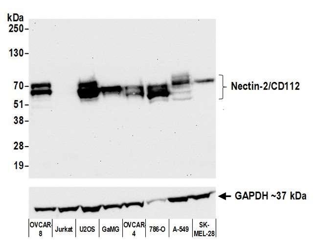 Nectin-2/CD112 Antibody in Western Blot (WB)