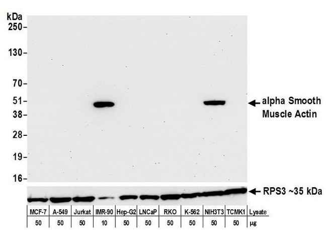 alpha Smooth Muscle Actin Antibody in Western Blot (WB)