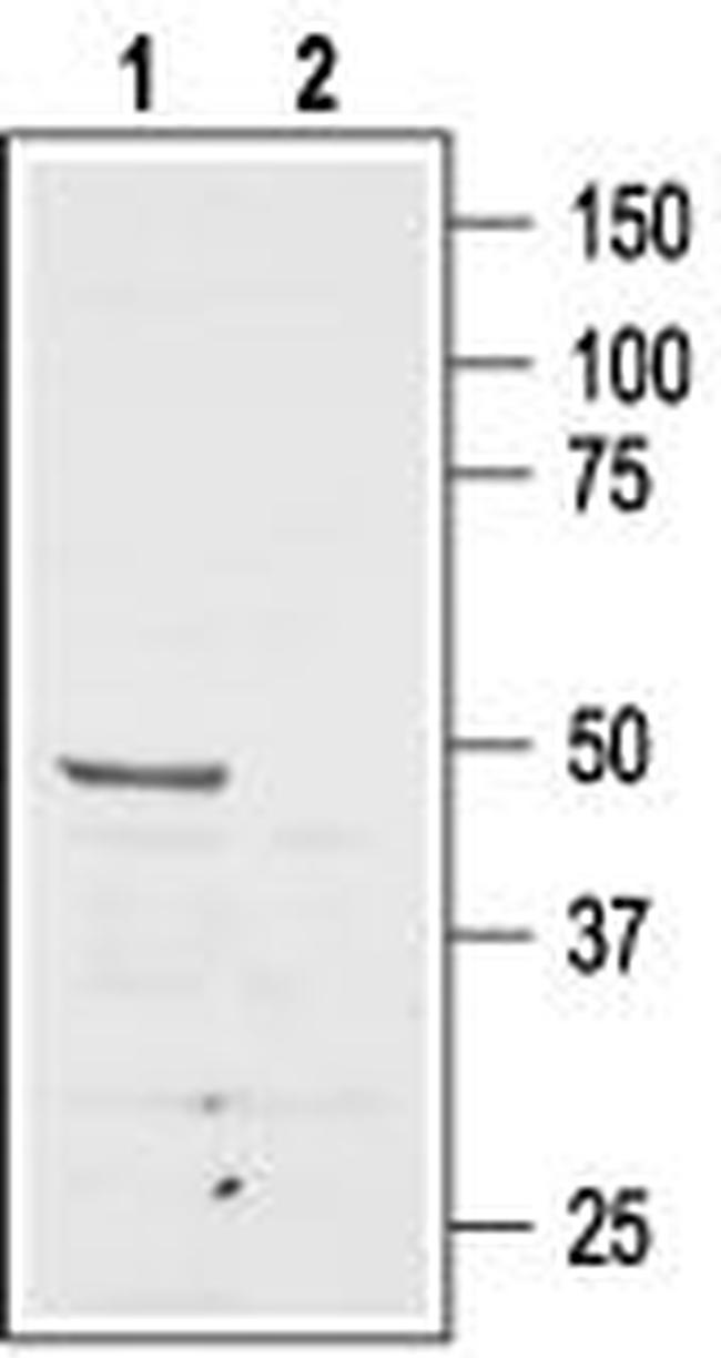 Angiotensin II Receptor Type-2 (extracellular) Antibody in Western Blot (WB)