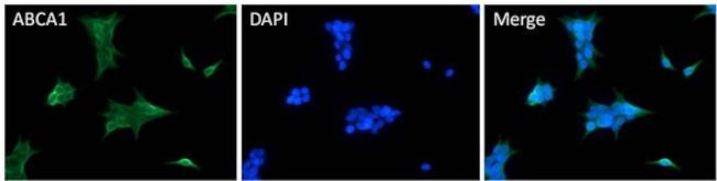ABCA1 Antibody in Immunocytochemistry (ICC/IF)