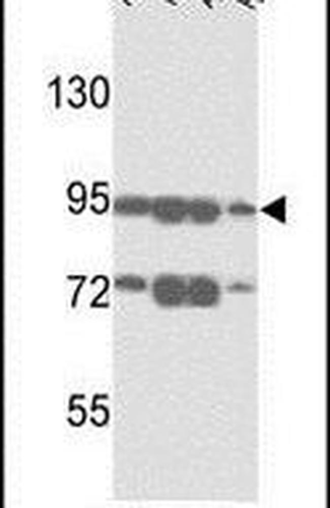 ABCB5 Antibody in Western Blot (WB)