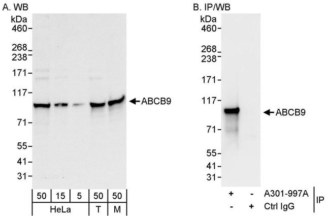 ABCB9 Antibody in Western Blot (WB)