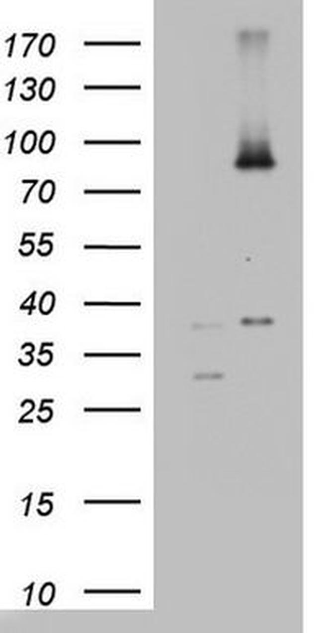 ABCD1 Antibody in Western Blot (WB)