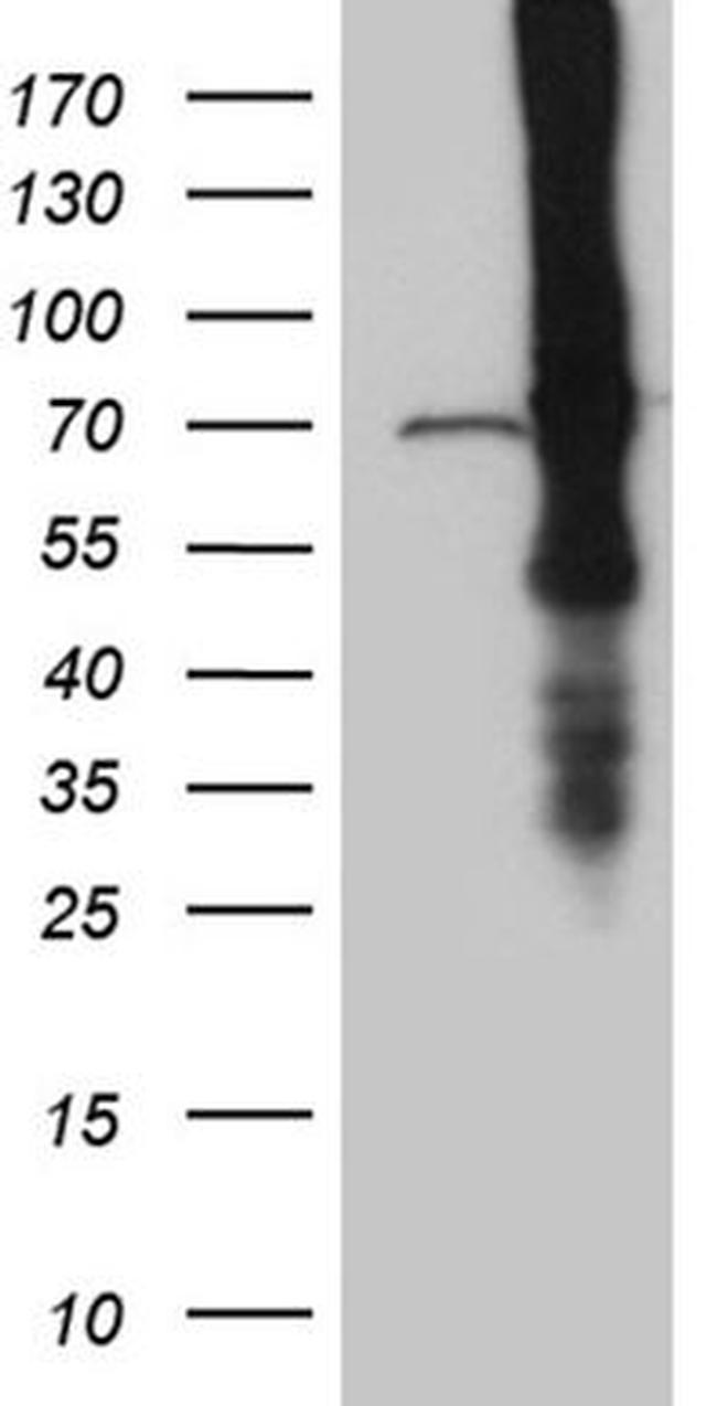 ABCF2 Antibody in Western Blot (WB)