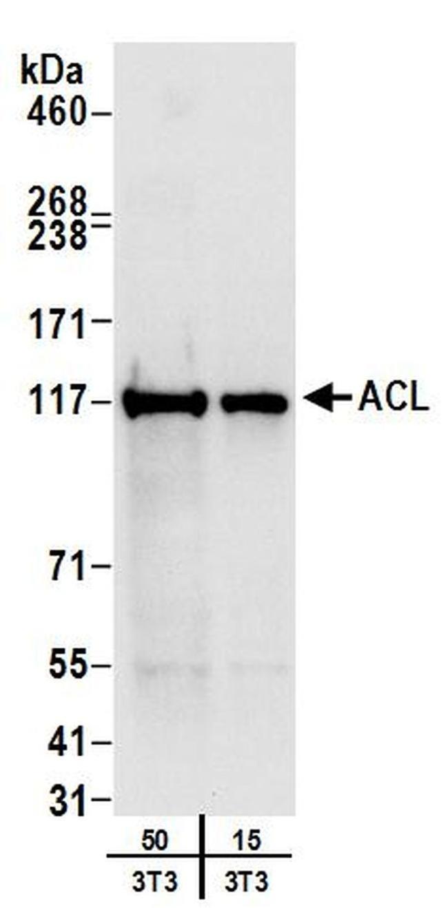 ACL Antibody in Western Blot (WB)