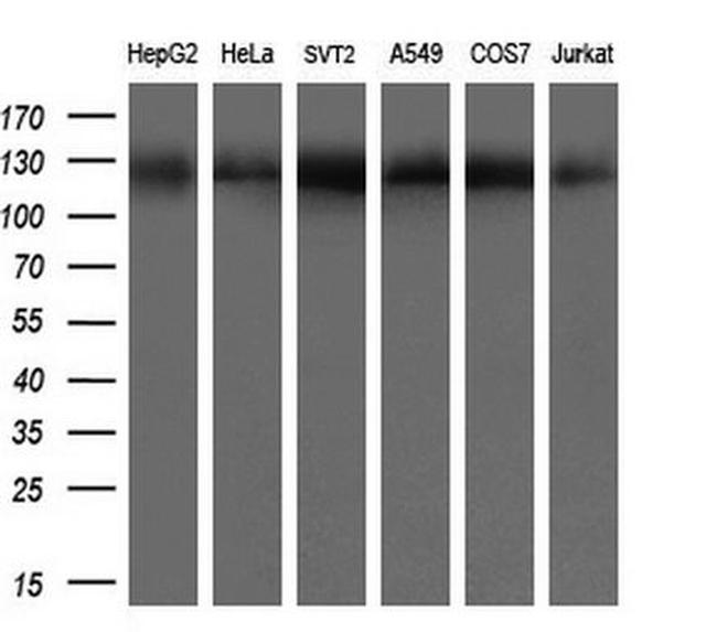 ACLY Antibody in Western Blot (WB)