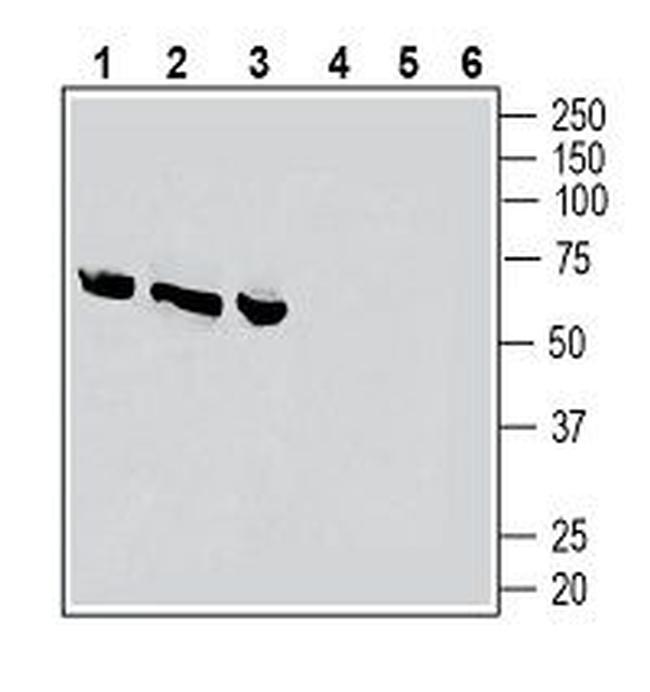 CRLR/CALCRL (extracellular) Antibody in Western Blot (WB)