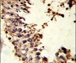 Acrosin Antibody in Immunohistochemistry (Paraffin) (IHC (P))