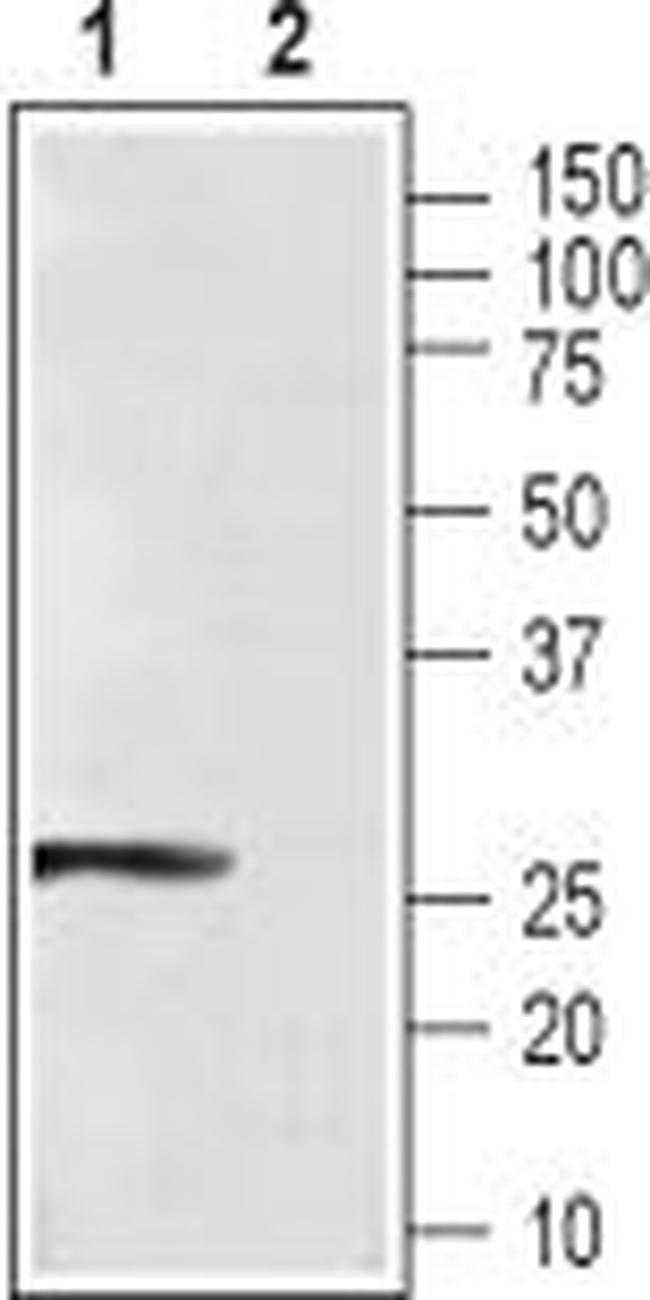 CaBP4 Antibody in Western Blot (WB)