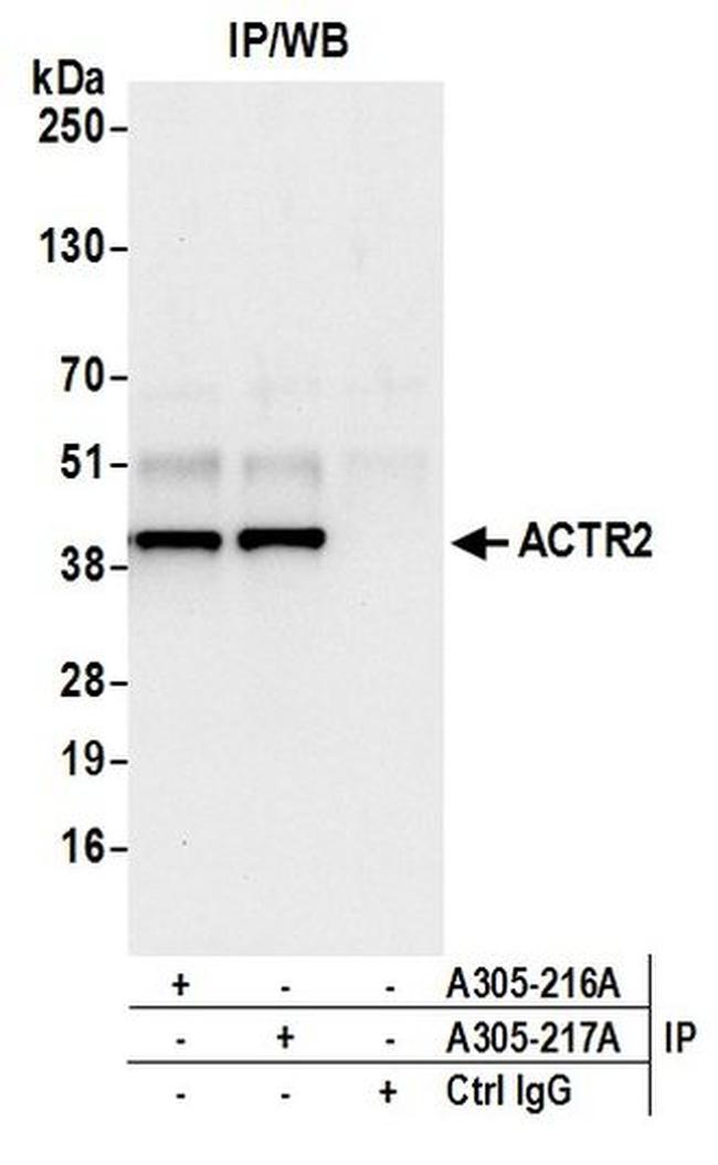 ACTR2/ARP2 Antibody in Western Blot (WB)
