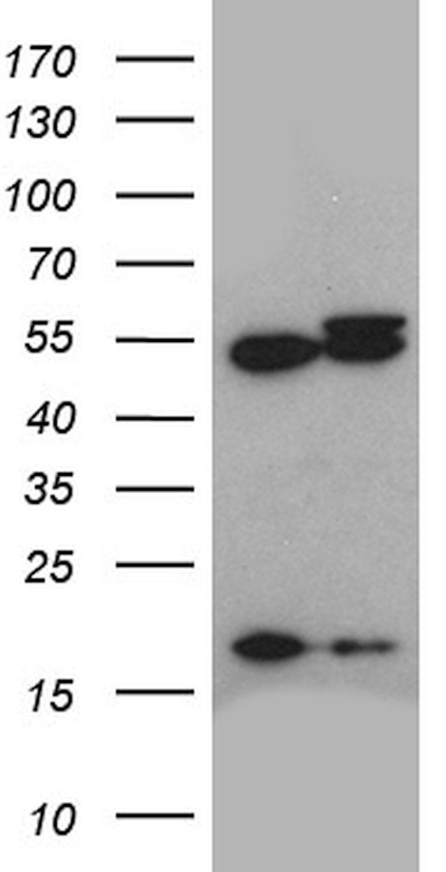 ACTR3 Antibody in Western Blot (WB)