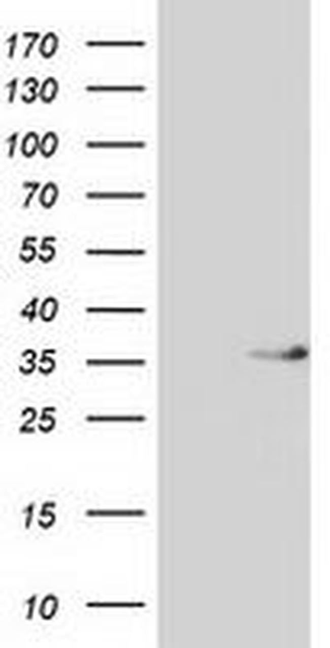 ACY3 Antibody in Western Blot (WB)