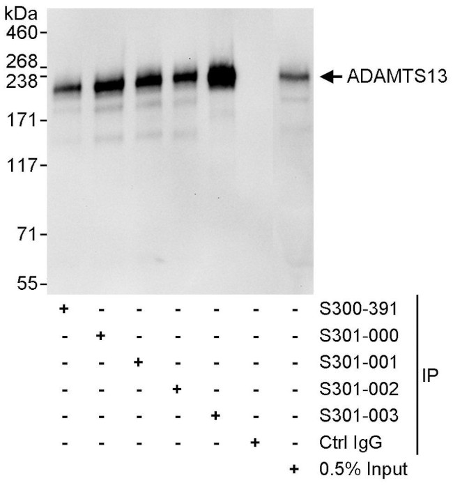 ADAMTS13 Antibody in Immunoprecipitation (IP)