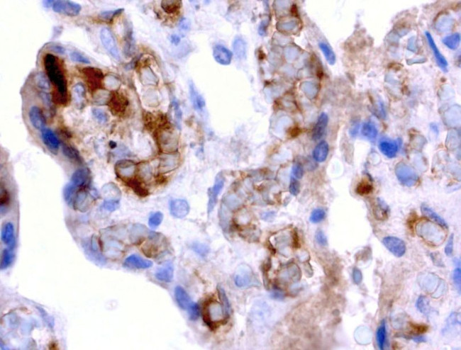AFP Antibody in Immunohistochemistry (Paraffin) (IHC (P))