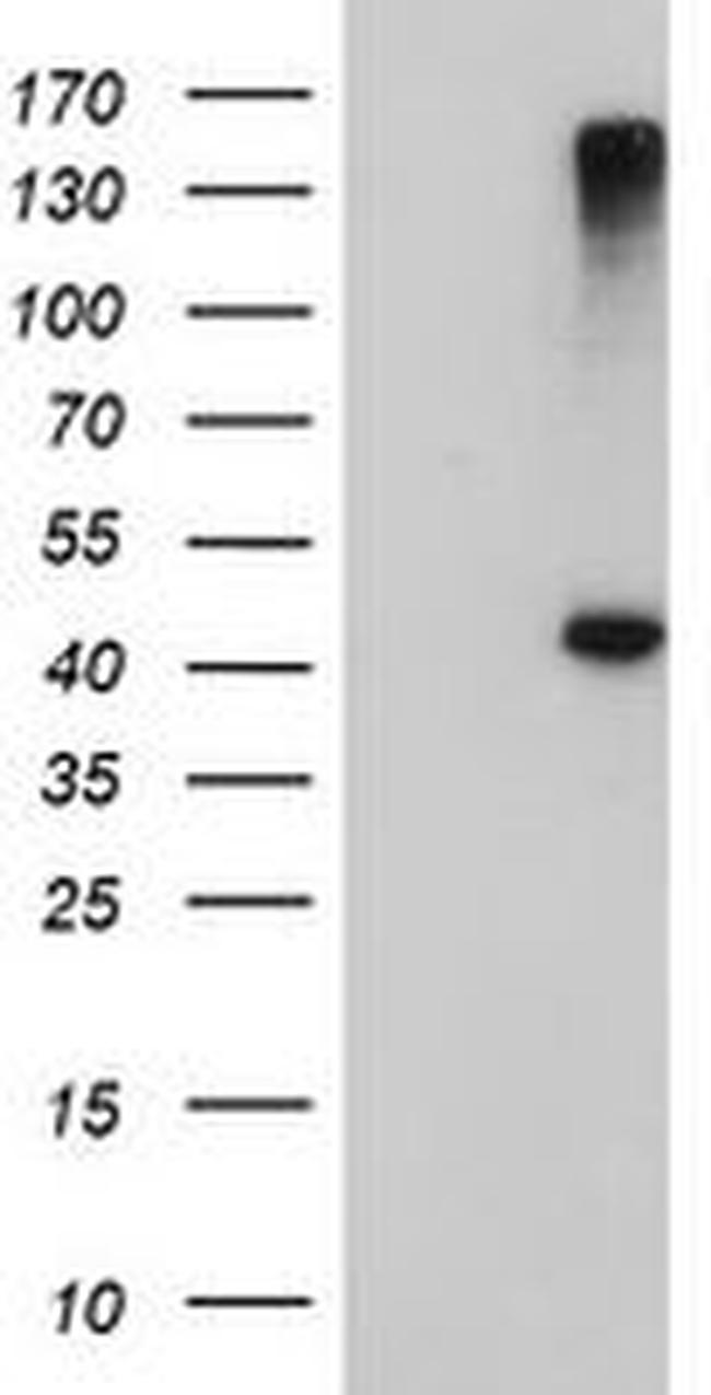 AGPAT5 Antibody in Western Blot (WB)