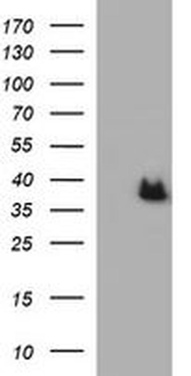 ARG2 Antibody in Western Blot (WB)