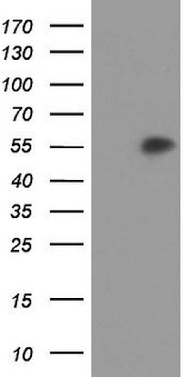 AGT Antibody in Western Blot (WB)