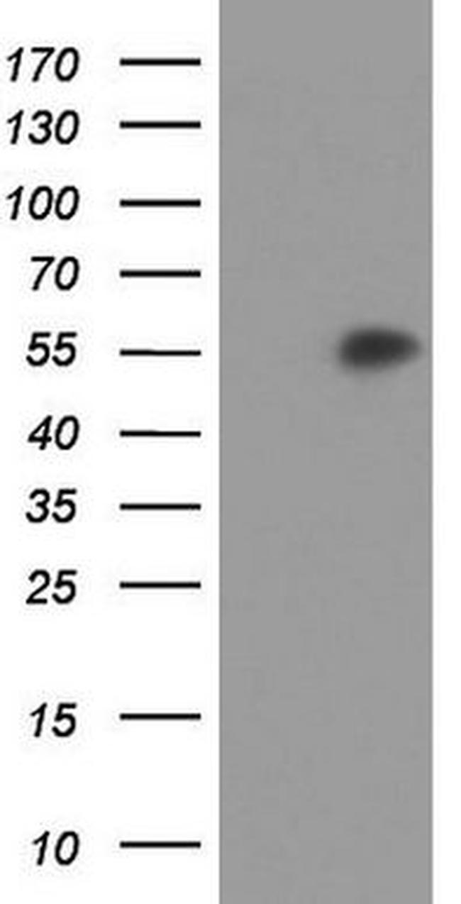 AGT Antibody in Western Blot (WB)
