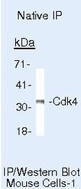 CDK4 Antibody in Immunoprecipitation (IP)