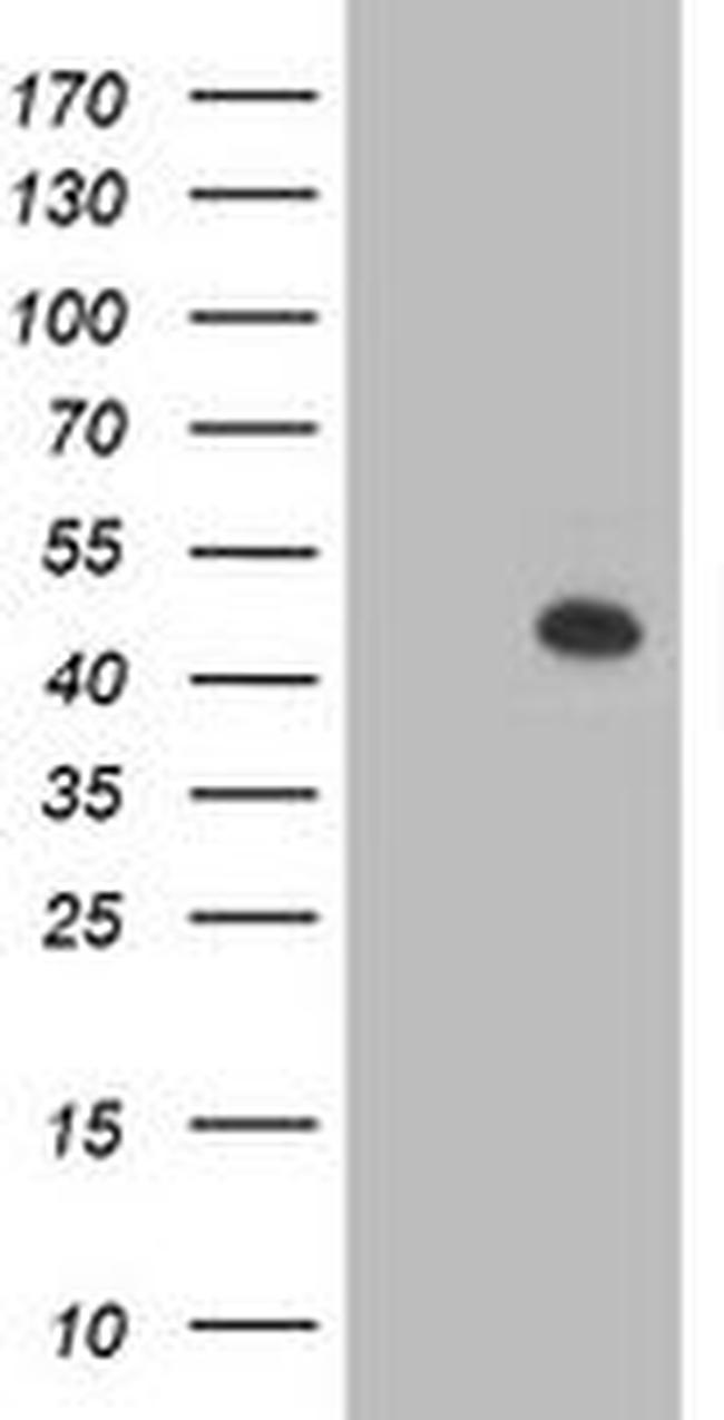 AIPL1 Antibody in Western Blot (WB)
