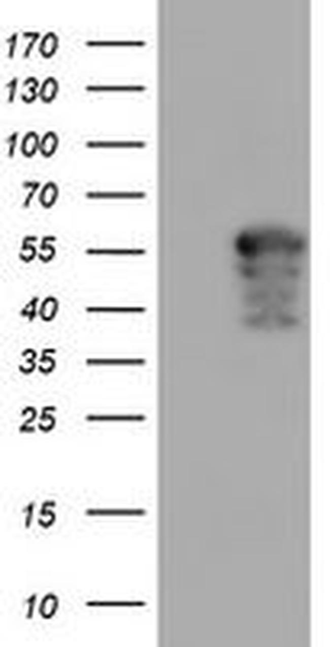 AIPL1 Antibody in Western Blot (WB)