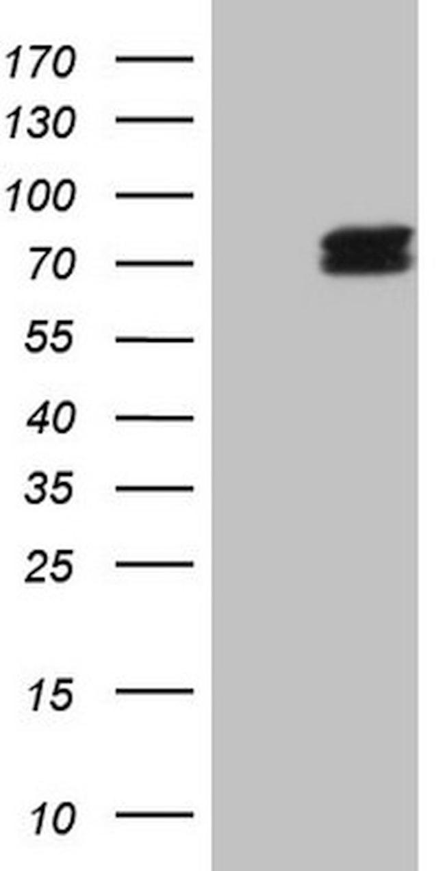 ALAS1 Antibody in Western Blot (WB)