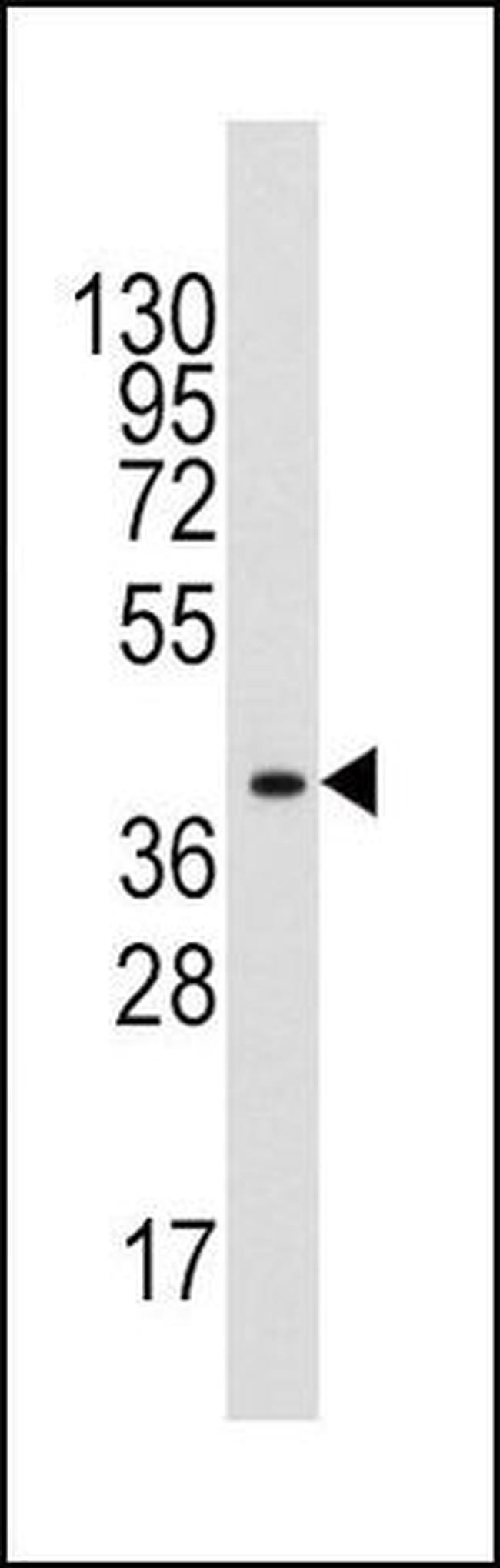 Aldolase A Antibody in Western Blot (WB)