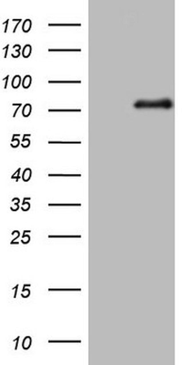 ALOX5 Antibody in Western Blot (WB)