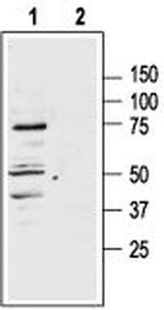 MC1 Receptor Antibody in Western Blot (WB)