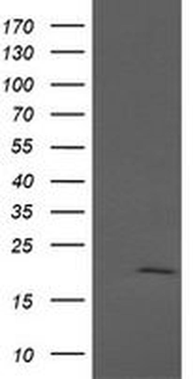 ANAPC11 Antibody in Western Blot (WB)