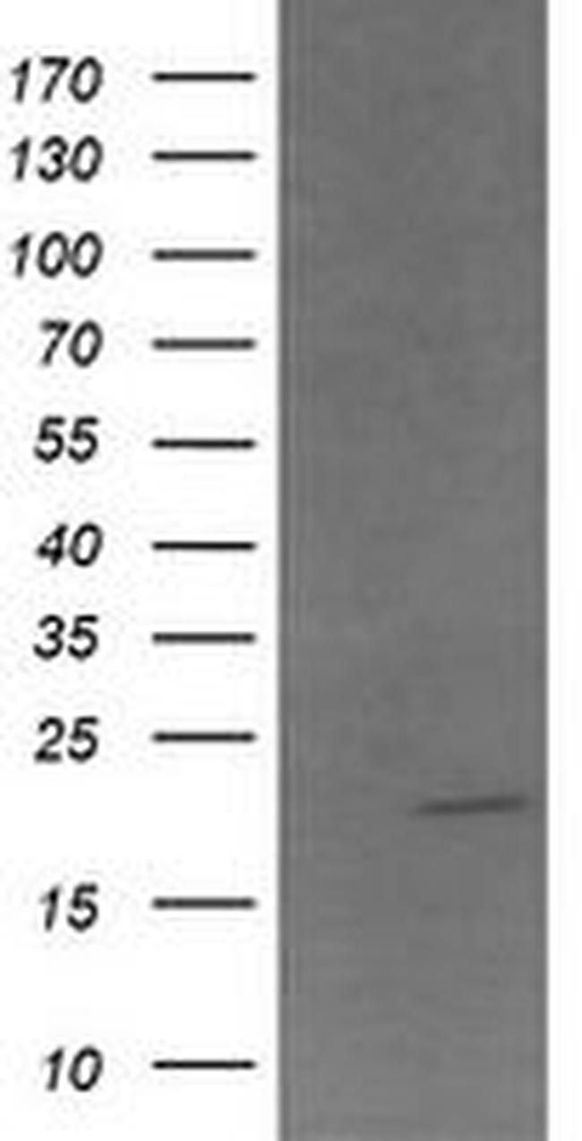 ANAPC11 Antibody in Western Blot (WB)