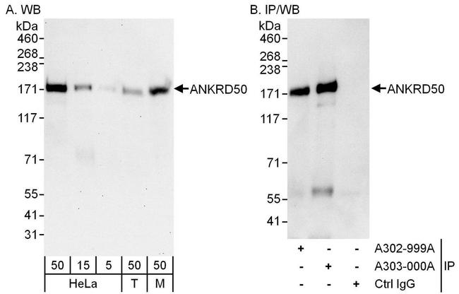 ANKRD50 Antibody in Western Blot (WB)