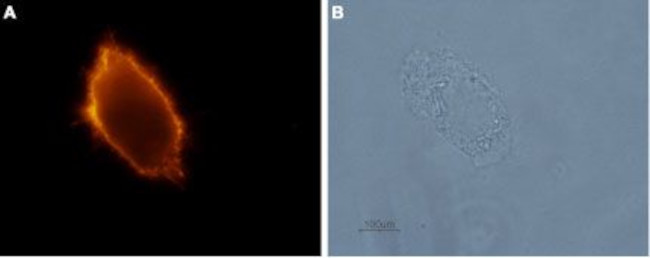 p75 NGF Receptor (extracellular) Antibody in Immunocytochemistry (ICC/IF)