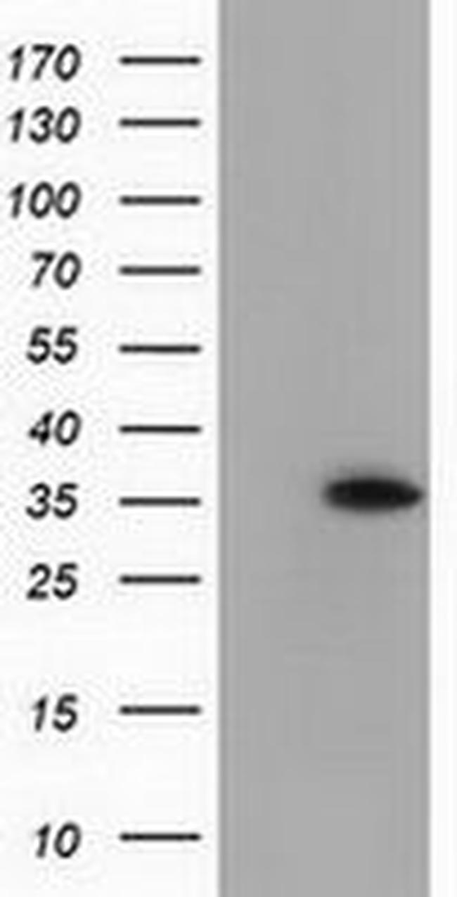 ANXA3 Antibody in Western Blot (WB)