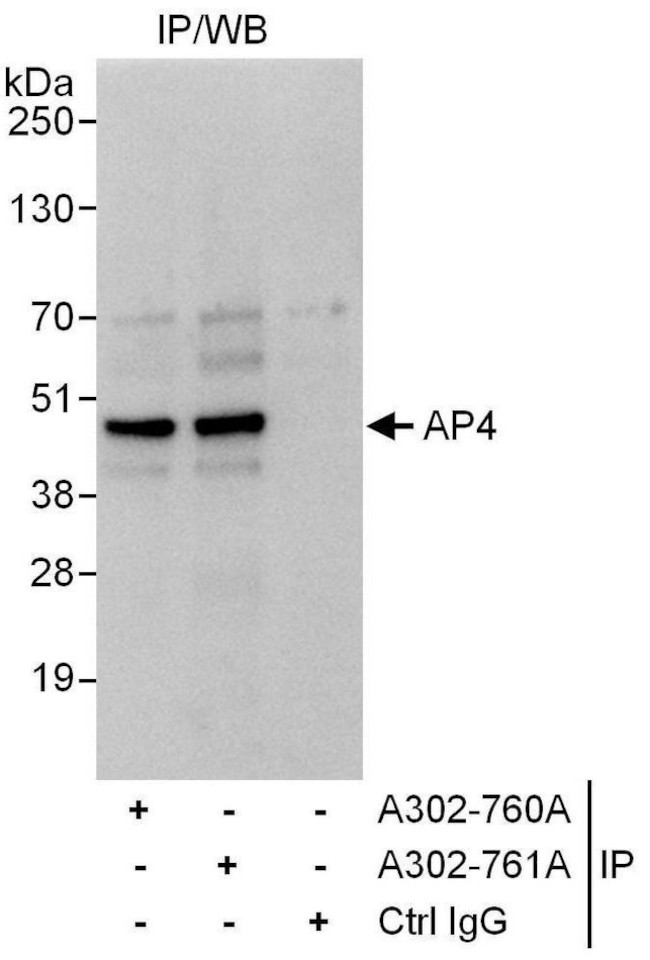 AP4 Antibody in Immunoprecipitation (IP)