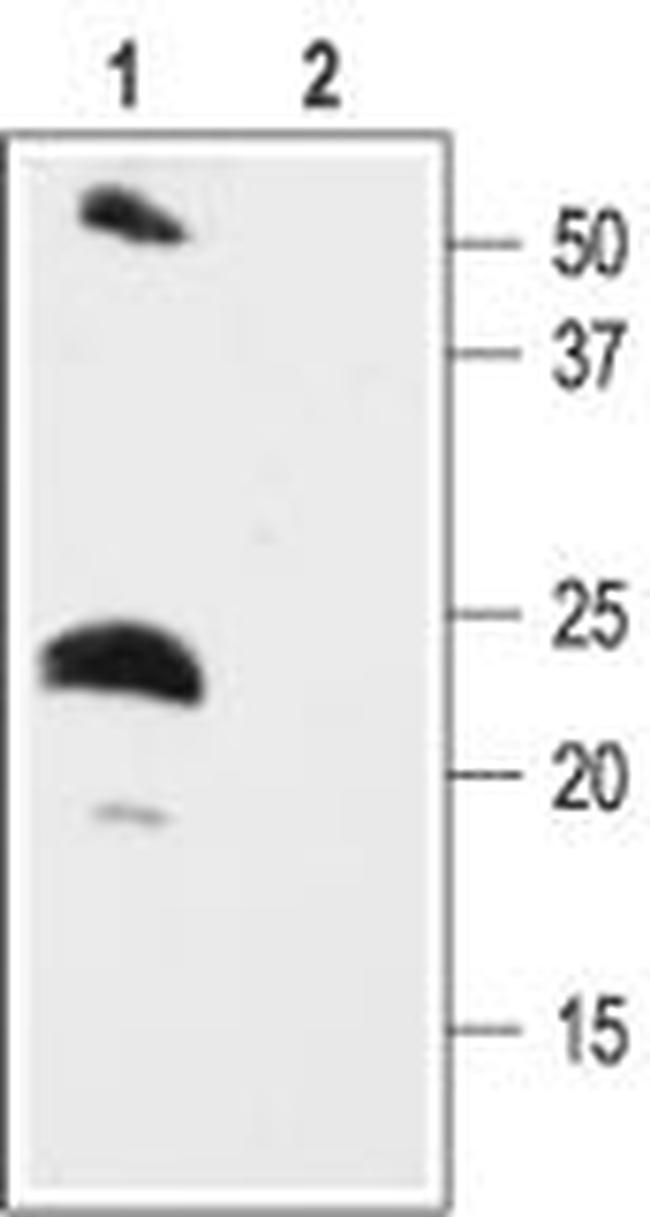 KCNE2 (MiRP1) Antibody in Western Blot (WB)