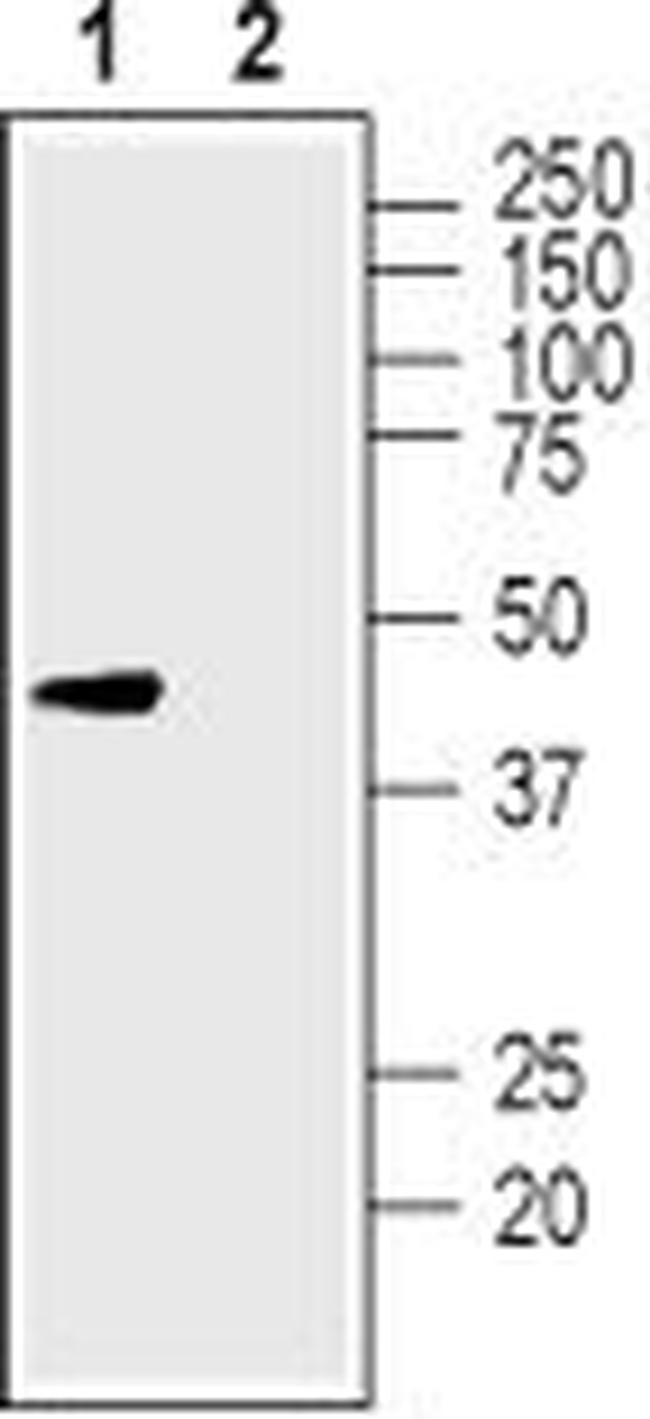 KCNK12 (THIK-2) (extracellular) Antibody in Western Blot (WB)