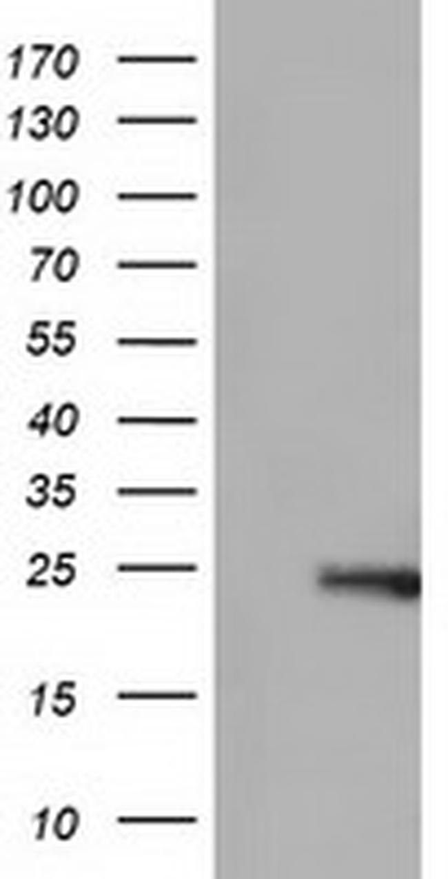 ARHGDIA Antibody in Western Blot (WB)
