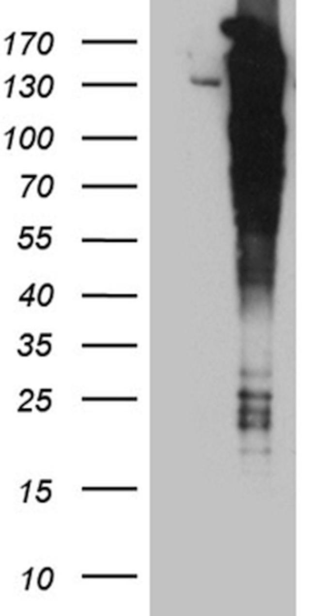 ARHGEF18 Antibody in Western Blot (WB)
