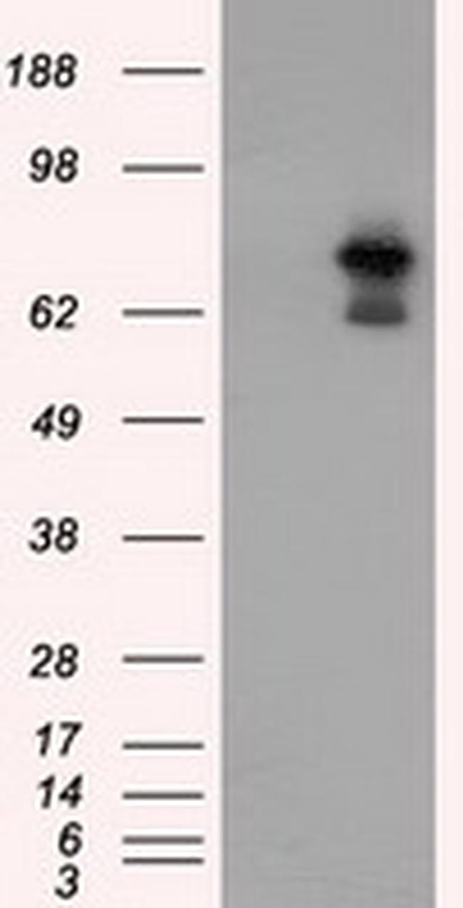ARNT Antibody in Western Blot (WB)