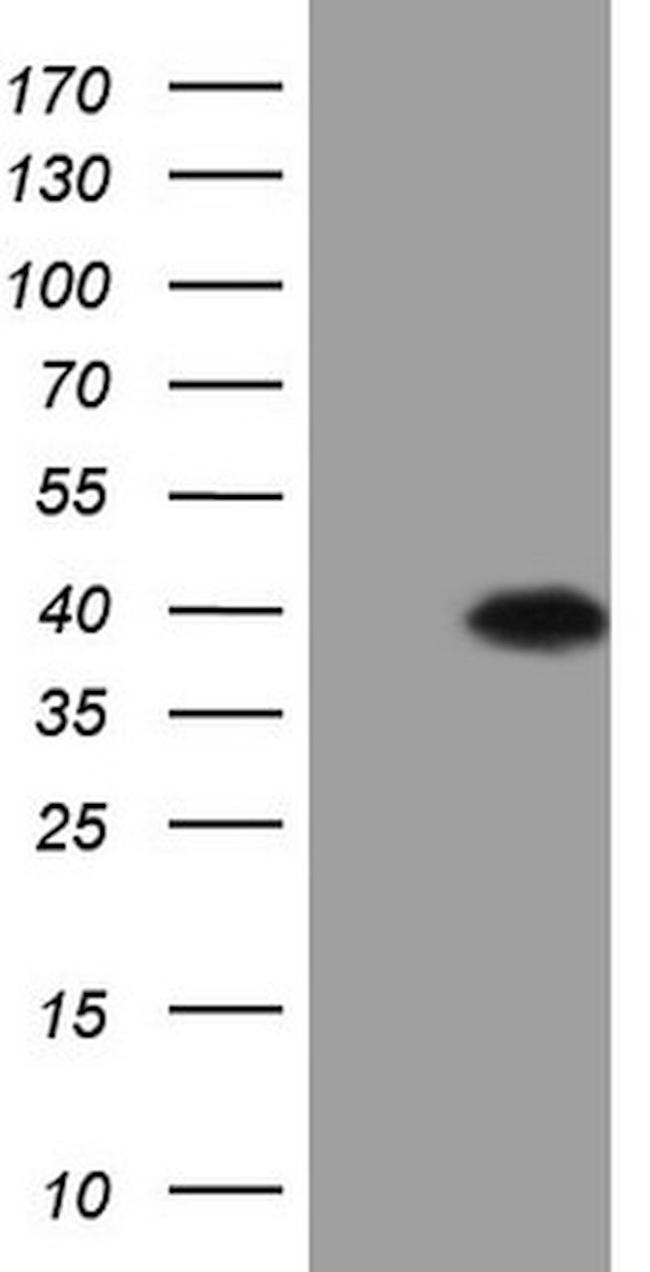 ASB8 Antibody in Western Blot (WB)
