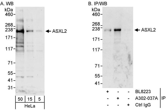 ASXL2 Antibody in Western Blot (WB)