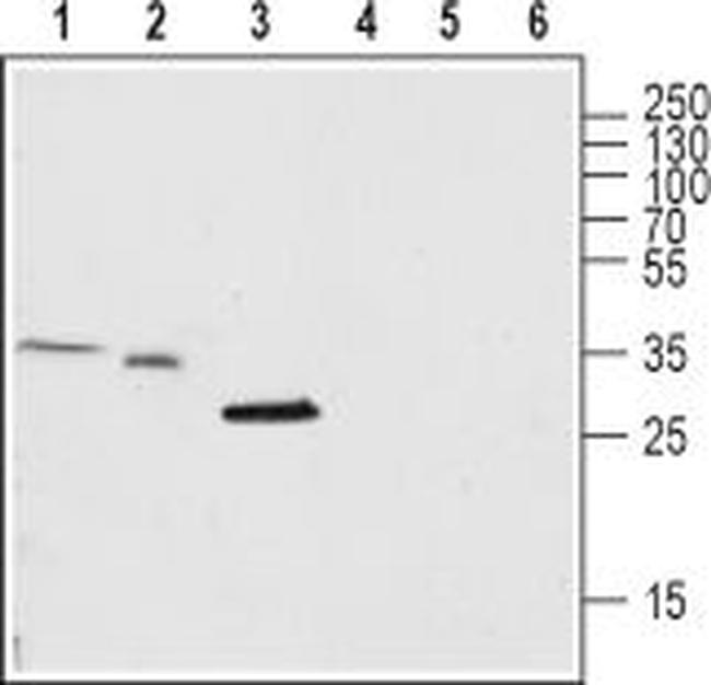 TRIC-A (TMEM38A) Antibody in Western Blot (WB)