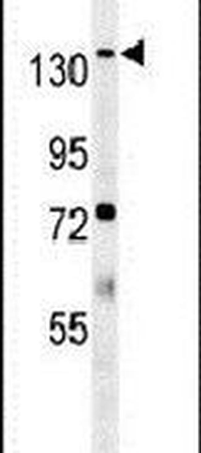 ATP11C Antibody in Western Blot (WB)