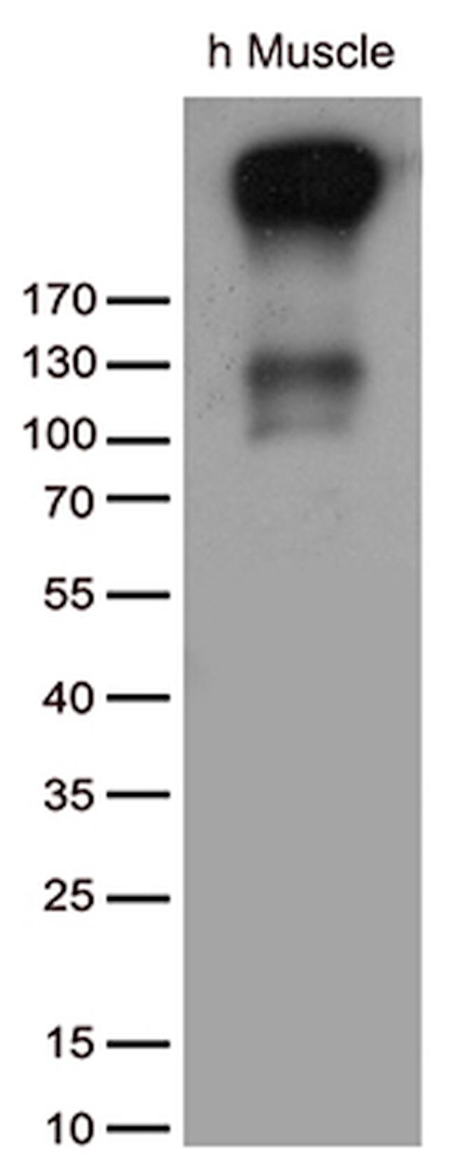 ATP2A2 Antibody in Western Blot (WB)