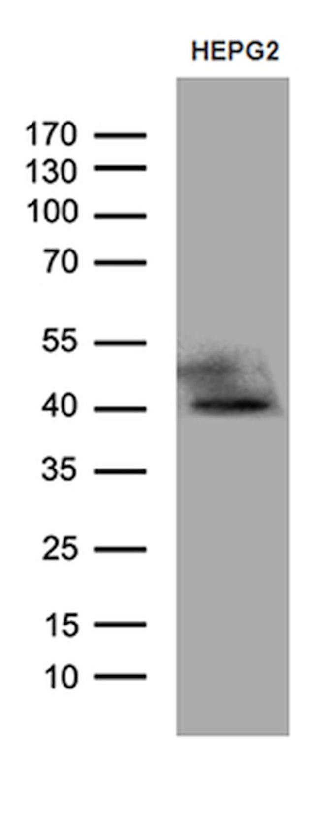 ATP6V0D2 Antibody in Western Blot (WB)