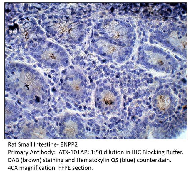 ENPP2 Antibody in Immunohistochemistry (Paraffin) (IHC (P))