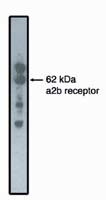 alpha-2b Adrenergic Receptor Antibody in Western Blot (WB)