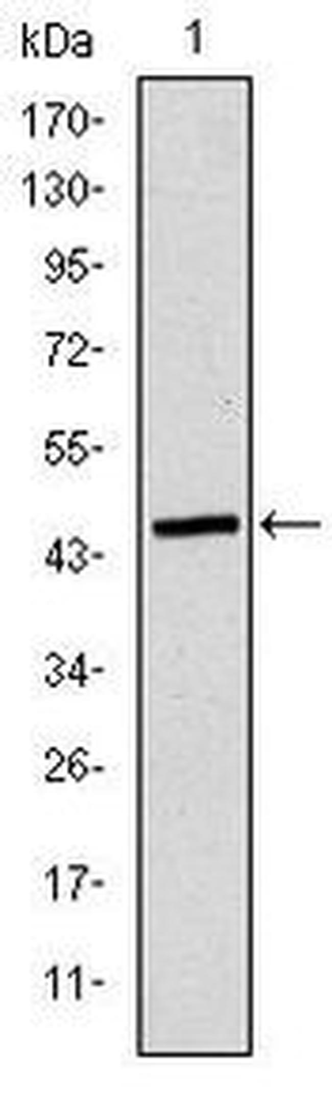 Apolipoprotein B Antibody in Western Blot (WB)