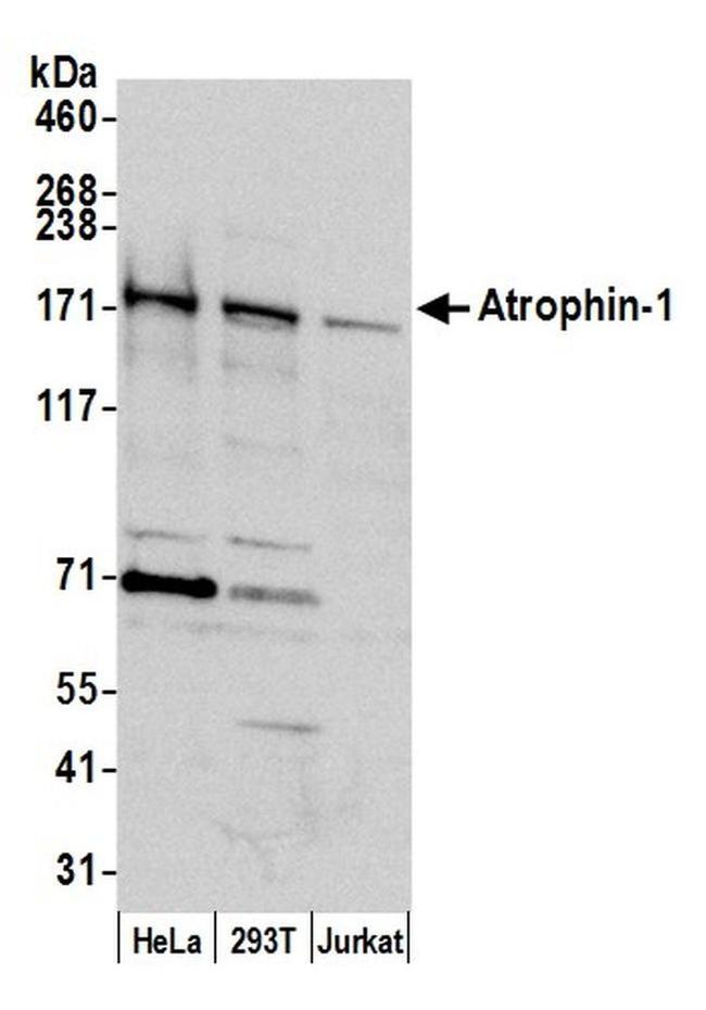 Atrophin 1 Antibody in Western Blot (WB)